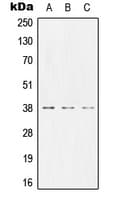IHC-plus™ CEACAM8 / CD66b Antibody (Internal)