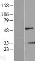 SHSF1 / SHFM1 Protein (Over-Expression Lysate Myc-DDK (Flag))