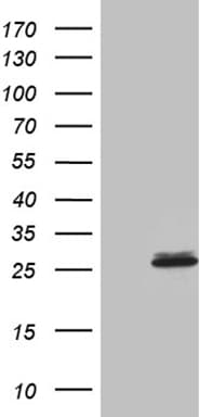 SLC9A1BP / CHP Antibody (clone OTI4B9)