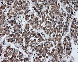 FAHD2A Antibody (clone OTI5E9)