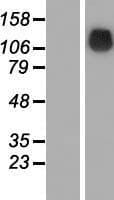 SRGAP1 Protein (Over-Expression Lysate Myc-DDK (Flag))