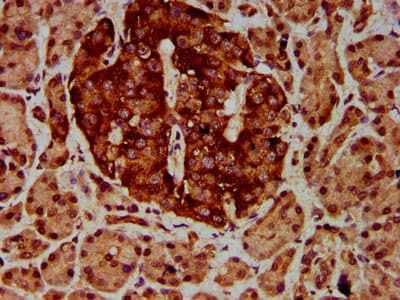 ETV5 / ERM Antibody