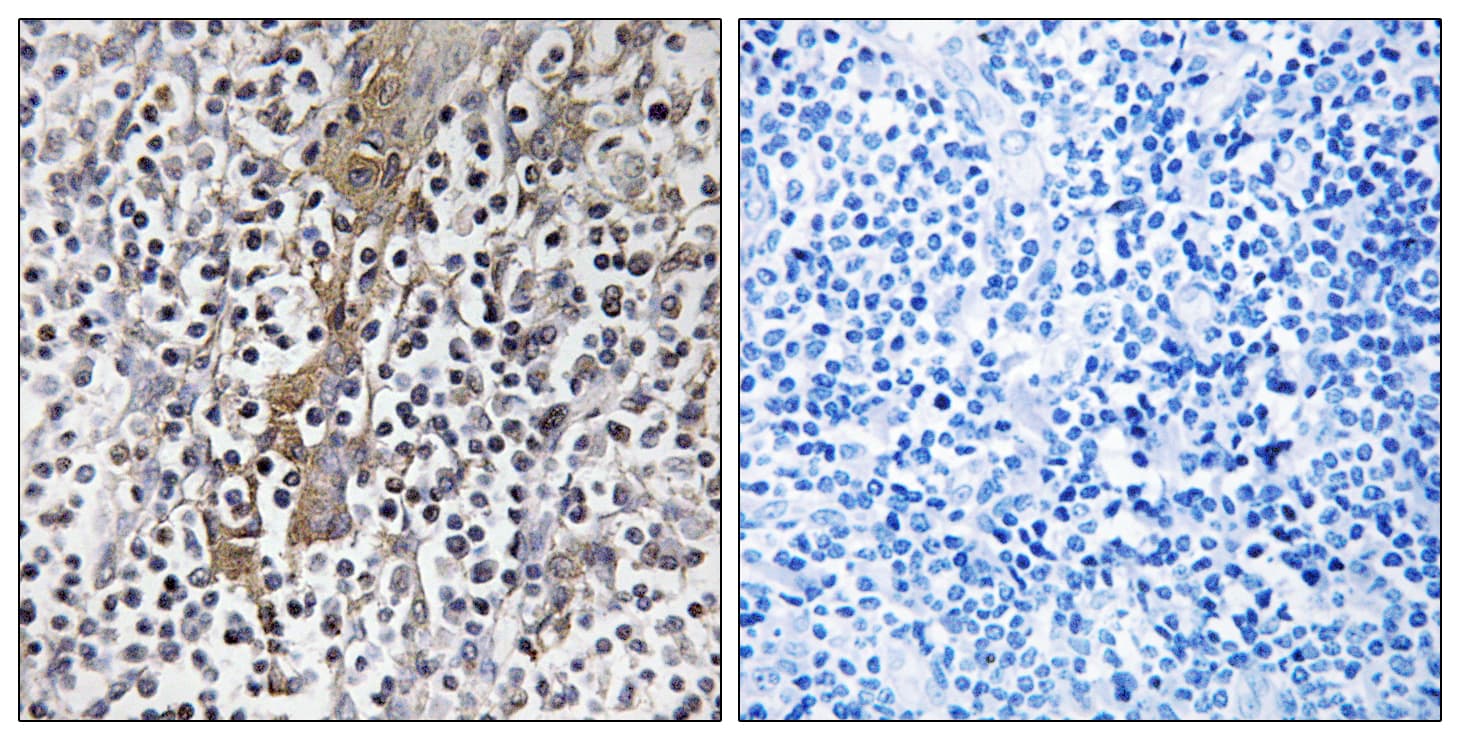 TMC8 / EVER2 Antibody (aa601-650)