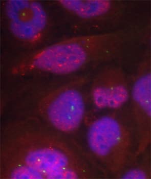 Polyclonal Rabbit anti-Human RELA / NFKB p65 Antibody (phospho-Ser276, IHC, IF, WB)