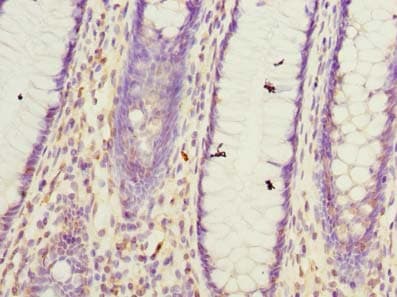 Polyclonal Rabbit anti-Human GHITM Antibody (IHC, WB)