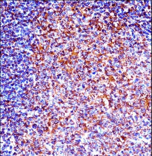 Polyclonal Rabbit anti-Human ZAP70 Antibody (aa103-130, IHC, WB)