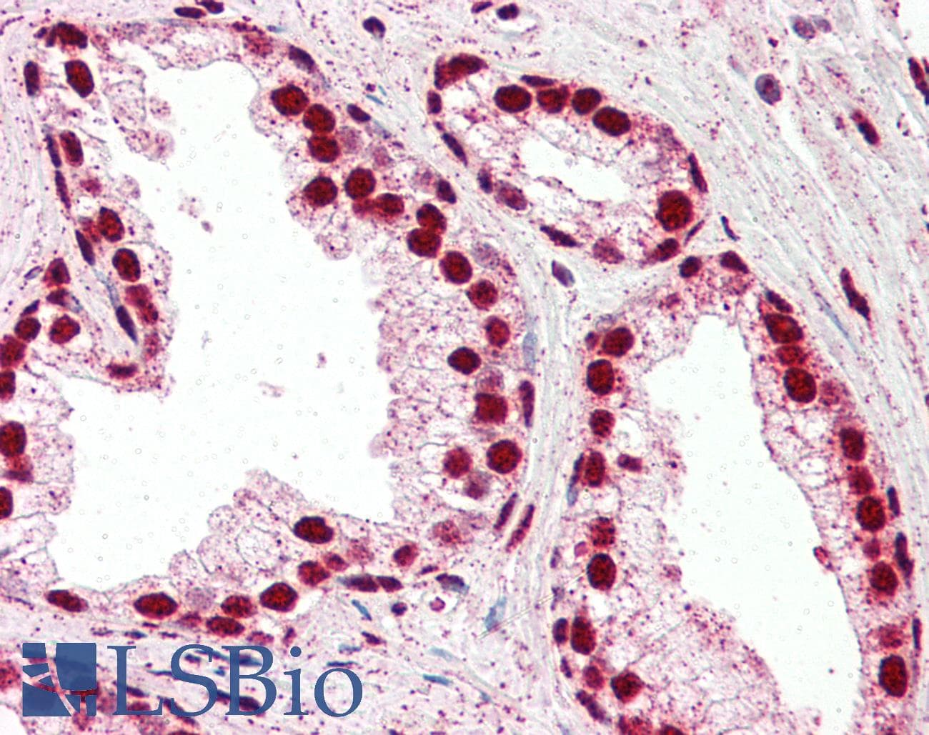 IHC-plus™ Polyclonal Goat anti-Human IRF6 Antibody (aa455-467, IHC, WB)
