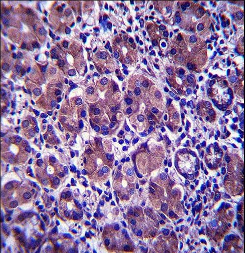 ANKRD22 Antibody (aa140-169)