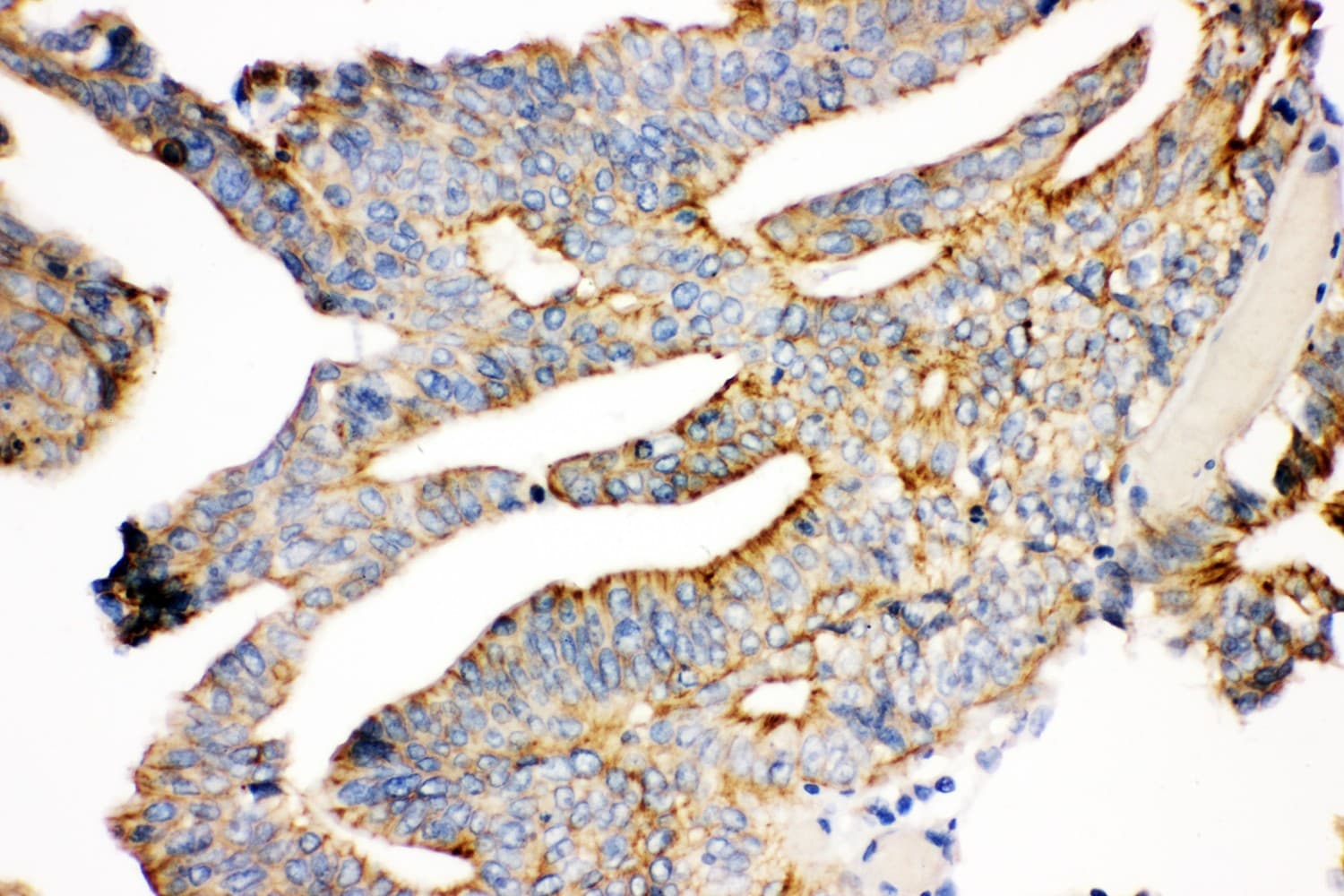 JUP/CTNNG/Junction Plakoglobin Antibody (aa556-745)