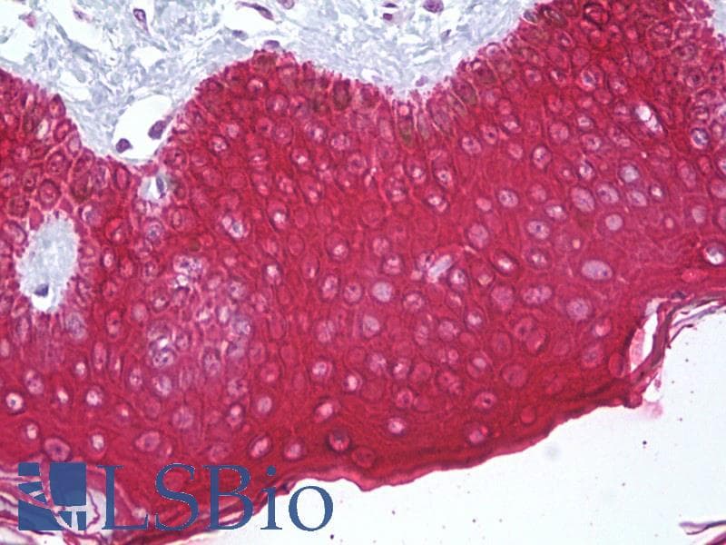 IHC-plus™ KRT10 / CK10 / Cytokeratin 10 Antibody (aa136-185)