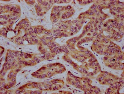 Polyclonal Rabbit anti-Human MS4A2 / FCERI Antibody (IHC, IF)