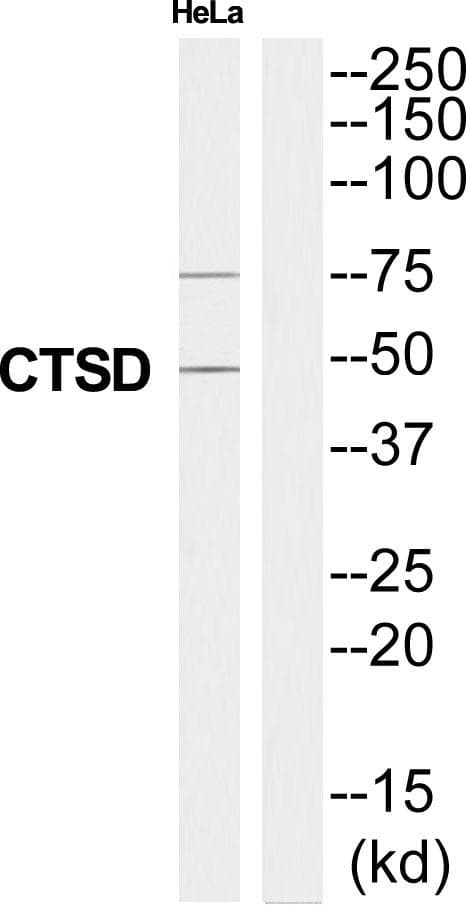 CTSD / Cathepsin D Antibody