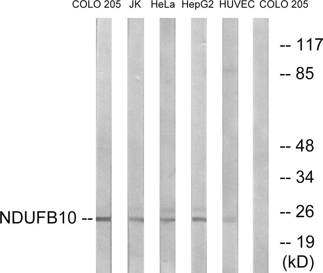 NDUFB10 Antibody