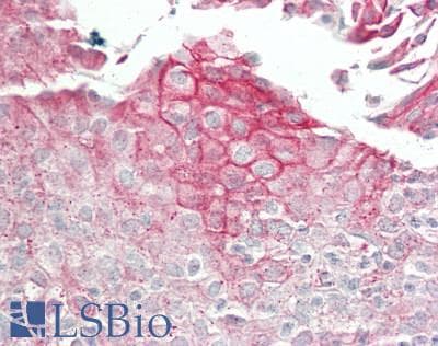 IHC-plus™ PPL / Periplakin Antibody (aa1150-1200)
