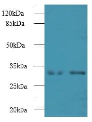 Polyclonal Rabbit anti-Human NMRAL1 / HSCARG Antibody (WB)