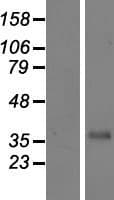 CFHR3 / CFHL3 Protein (Over-Expression Lysate Myc-DDK (Flag))