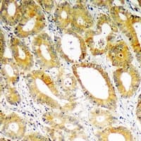 PDK4 Antibody