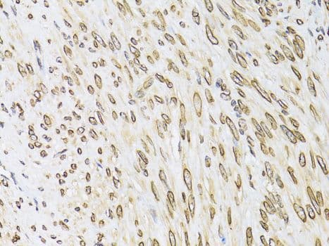 EMD / Emerin Antibody