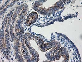 AK4 / Adenylate Kinase 4 Antibody (clone OTI2D1, Carrier-free)