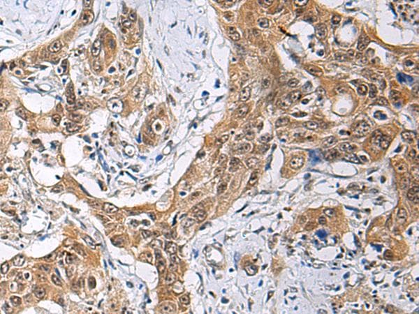 Polyclonal Rabbit anti-Human THOC3 Antibody (IHC)