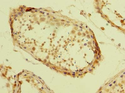 ZBTB32 / TZFP Antibody (aa1-294)