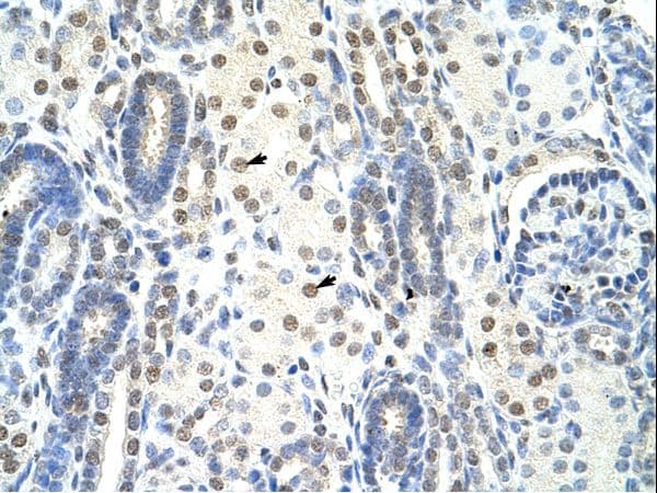 SF1 Antibody (N-Terminus)