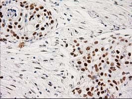 PRKCE / PKC-Epsilon Antibody (clone OTI4G8)