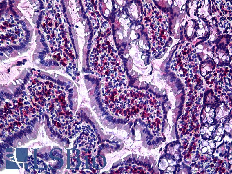 IHC-plus™ GJB2 / CX26 / Connexin 26 Antibody (Cytoplasmic Domain, clone CX-12H10)