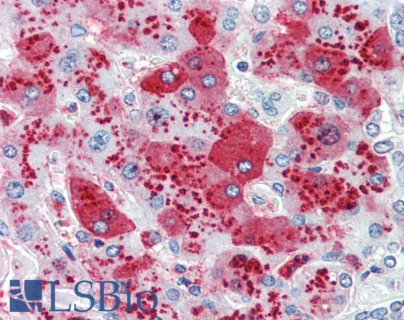 IHC-plus™ CDCP1 Antibody (Internal)