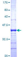 Human GPC1 / Glypican Protein (Recombinant GST, N-terminus)