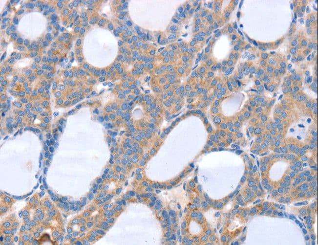 Polyclonal Rabbit anti-Human SLC25A13 / CITRIN Antibody (IHC, WB)
