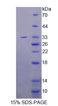 Mouse METRN / Meteorin Protein (Recombinant His-T7)