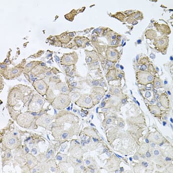 ATP1B1 Antibody