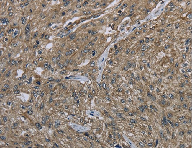 CLPS / Colipase Antibody