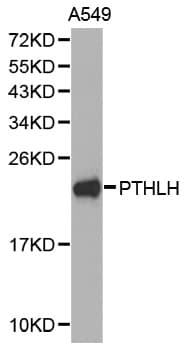 IHC-plus™ PTHLH / PTHRP Antibody (aa25-175)
