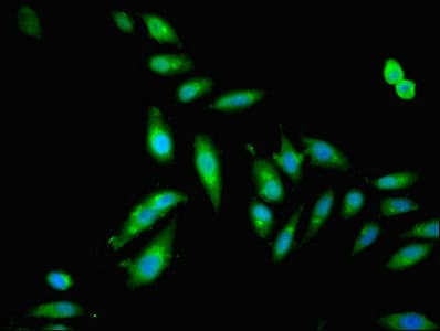 IHC-plus™ DFNA5 Antibody