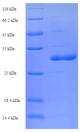 Human SARAF / TMEM66 Protein (Recombinant His-SUMO)