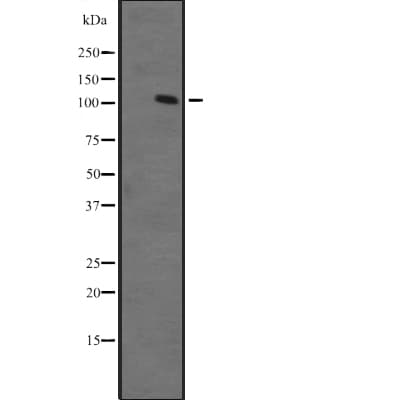 ZFPM1 / FOG1 Antibody