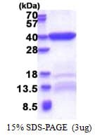 Human BEND6 Protein (Recombinant His)
