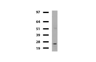 VBP1 Antibody (clone UMAB75)