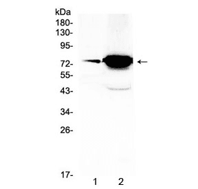 Polyclonal Rabbit anti-Human FSH Receptor / FSHR Antibody (WB)
