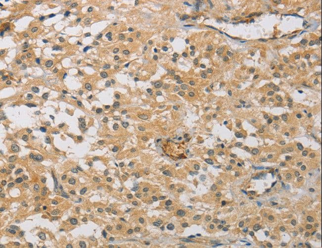 CENPF / CENP-F Antibody