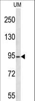 Polyclonal Rabbit anti-Human KAT2A / GCN5 Antibody (aa611-638, WB)