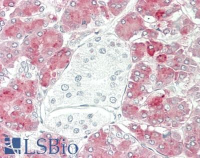 IHC-plus™ CPA1 / Carboxypeptidase A Antibody (aa301-350)