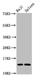 GABARAPL2 / ATG8 Antibody