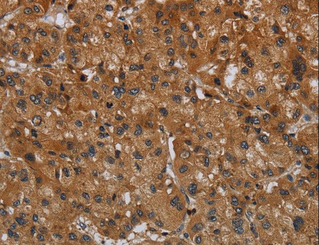ERBB4 / HER4 Antibody