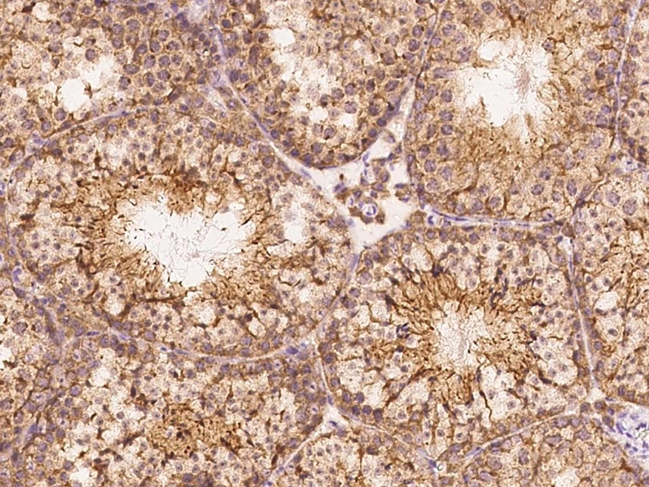 ADGRG2 / GPR64 Antibody