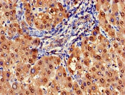 Polyclonal Rabbit anti-Human ARG1 / Arginase 1 Antibody (IHC, WB)