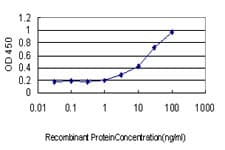 Monoclonal Mouse anti-Human ASCL1 / MASH1 Antibody (clone 7E11, WB)
