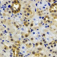 ADH4 Antibody
